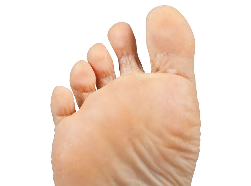 FUNGER-GOOD-PAIR-Y-HECTIC-CREAM-DEMYXIL