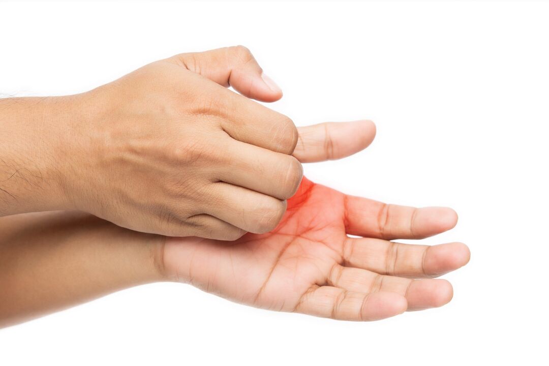 Picazón con hongos y su tratamiento con crema de demyxil